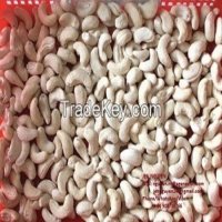Cashew exports: Tough nut to crack due to global fluctuations